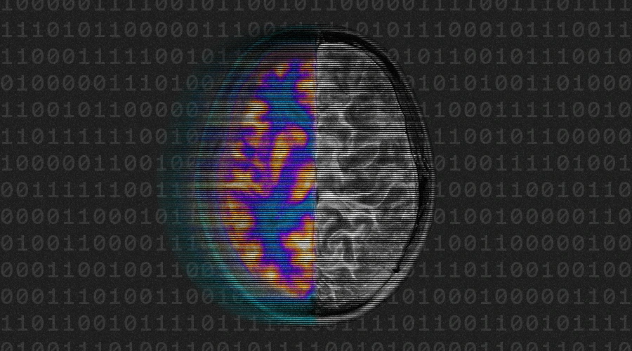 AI brain scan