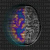 AI brain scan