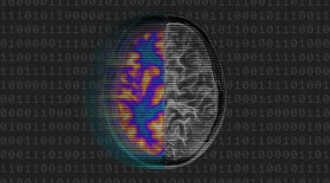 AI brain scan